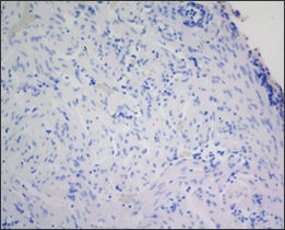 20120521-salmon disease HSMI 33.jpg